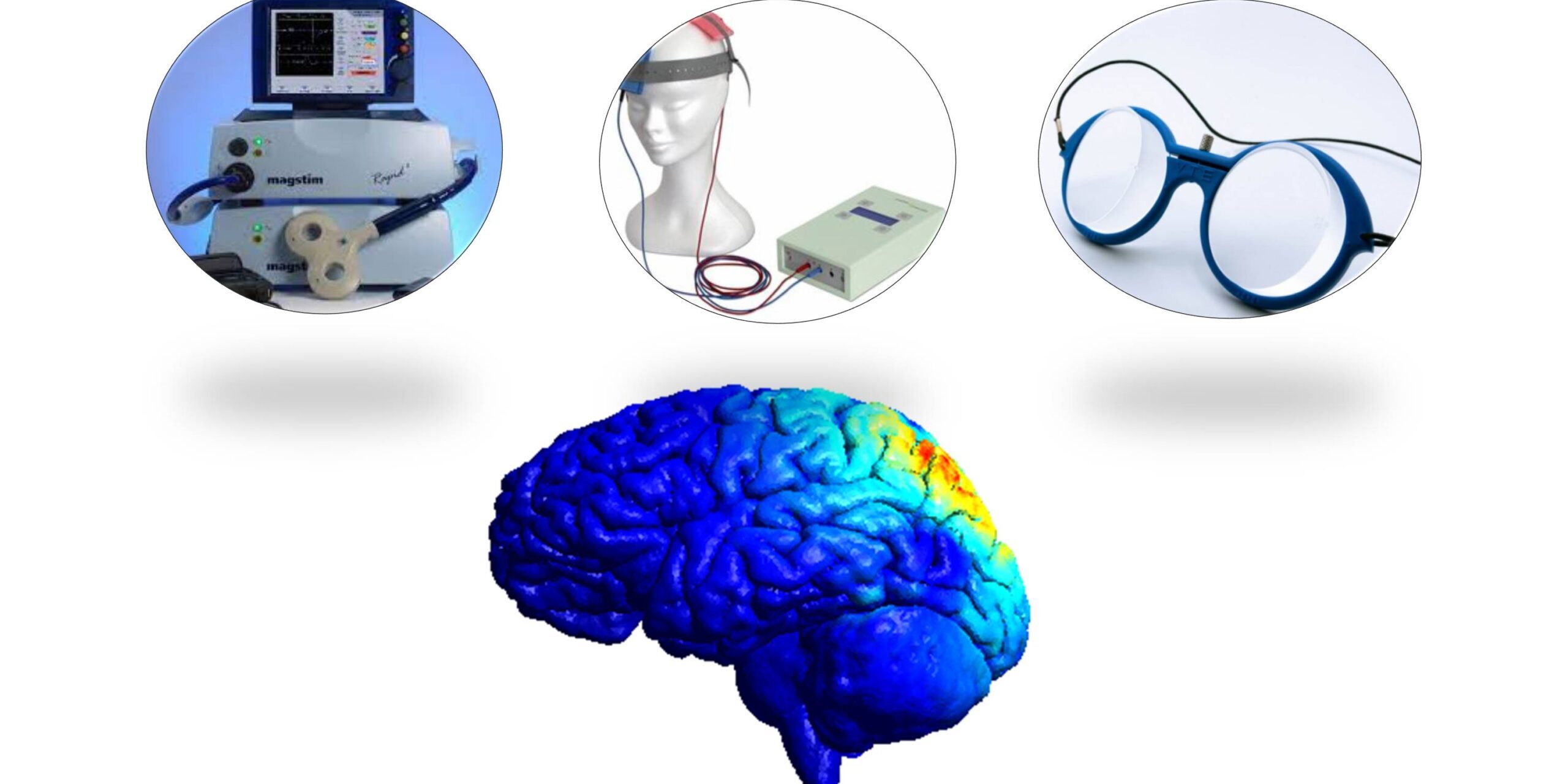 Potenziare l’attività del cervello con la neuromodulazione