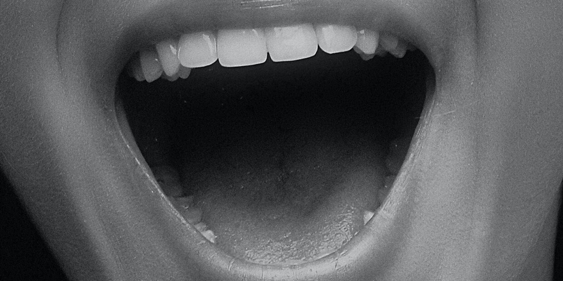 CURIOSA – I TUMORI DEL CAVO ORALE E L’IMPORTANZA DELLO STILE DI VITA