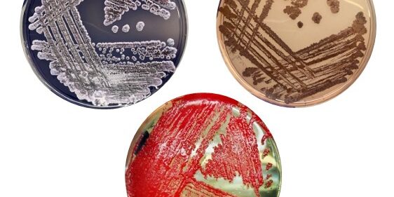 Microrganismi: alla scoperta del mondo invisibile